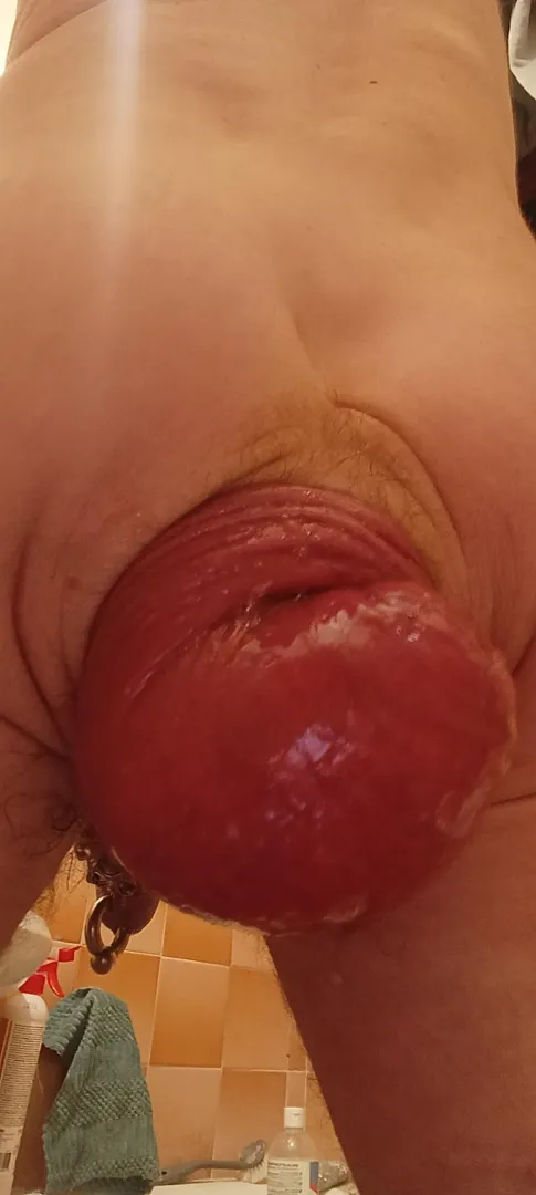 My prolapse after fisting from the back