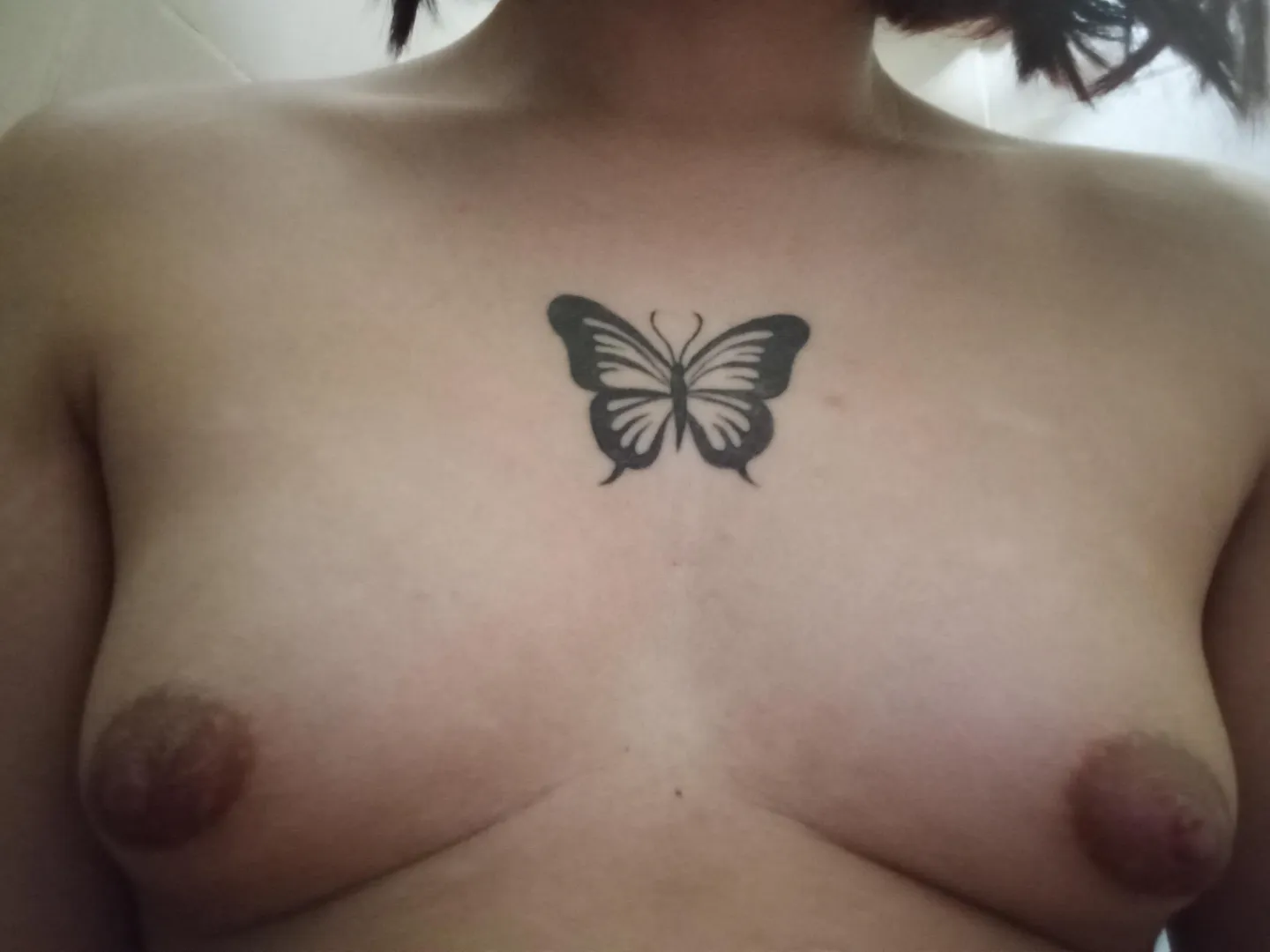 17 months on HRT (Breast update)