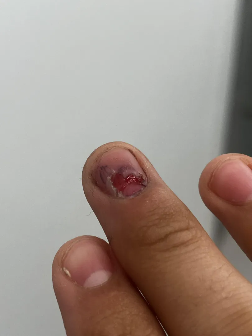 Boxcutter to my nail