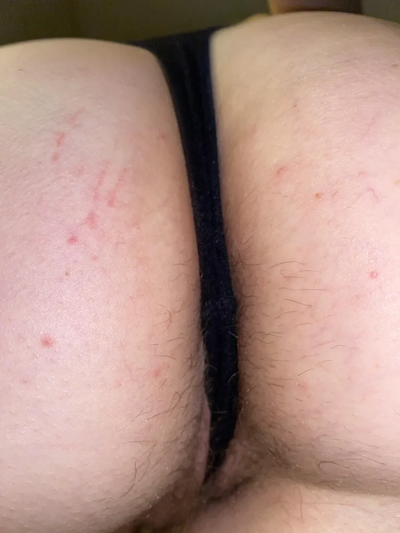 lick my hole every day