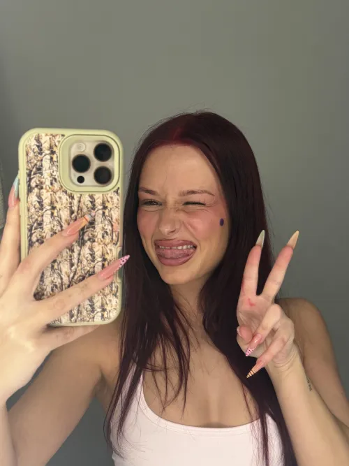 Who wants back scratches?