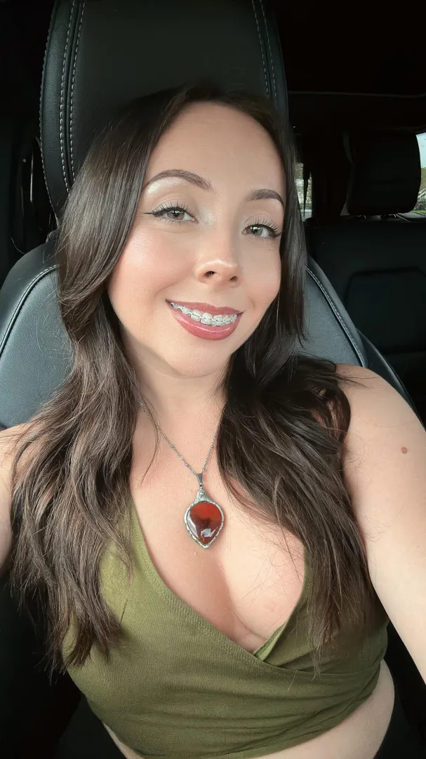 your little brace face <3