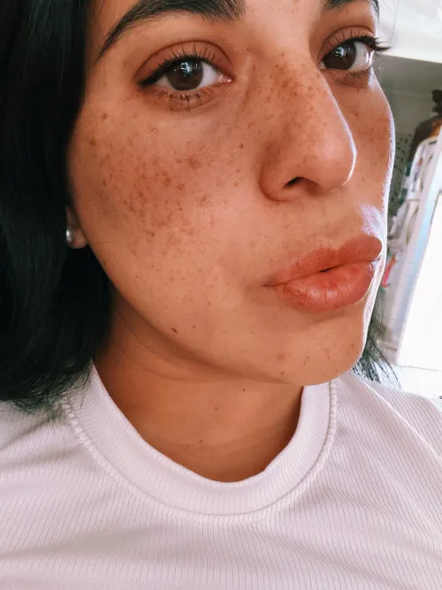 Do you like my freckled nose?