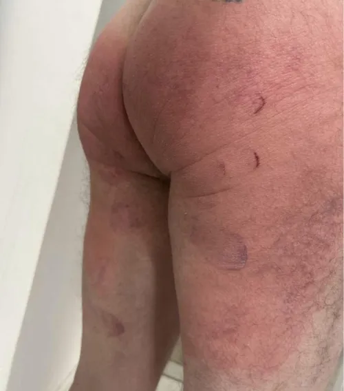 She gave me the belt!