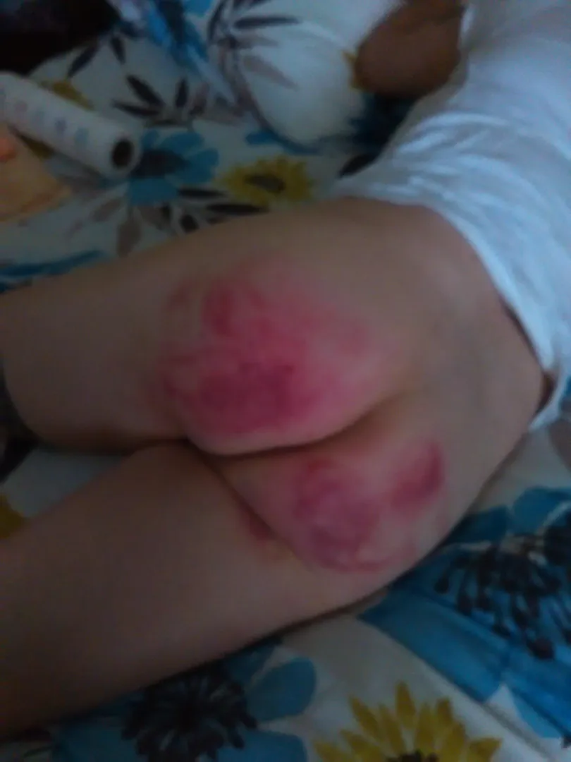 Speeding Ticket Consequences