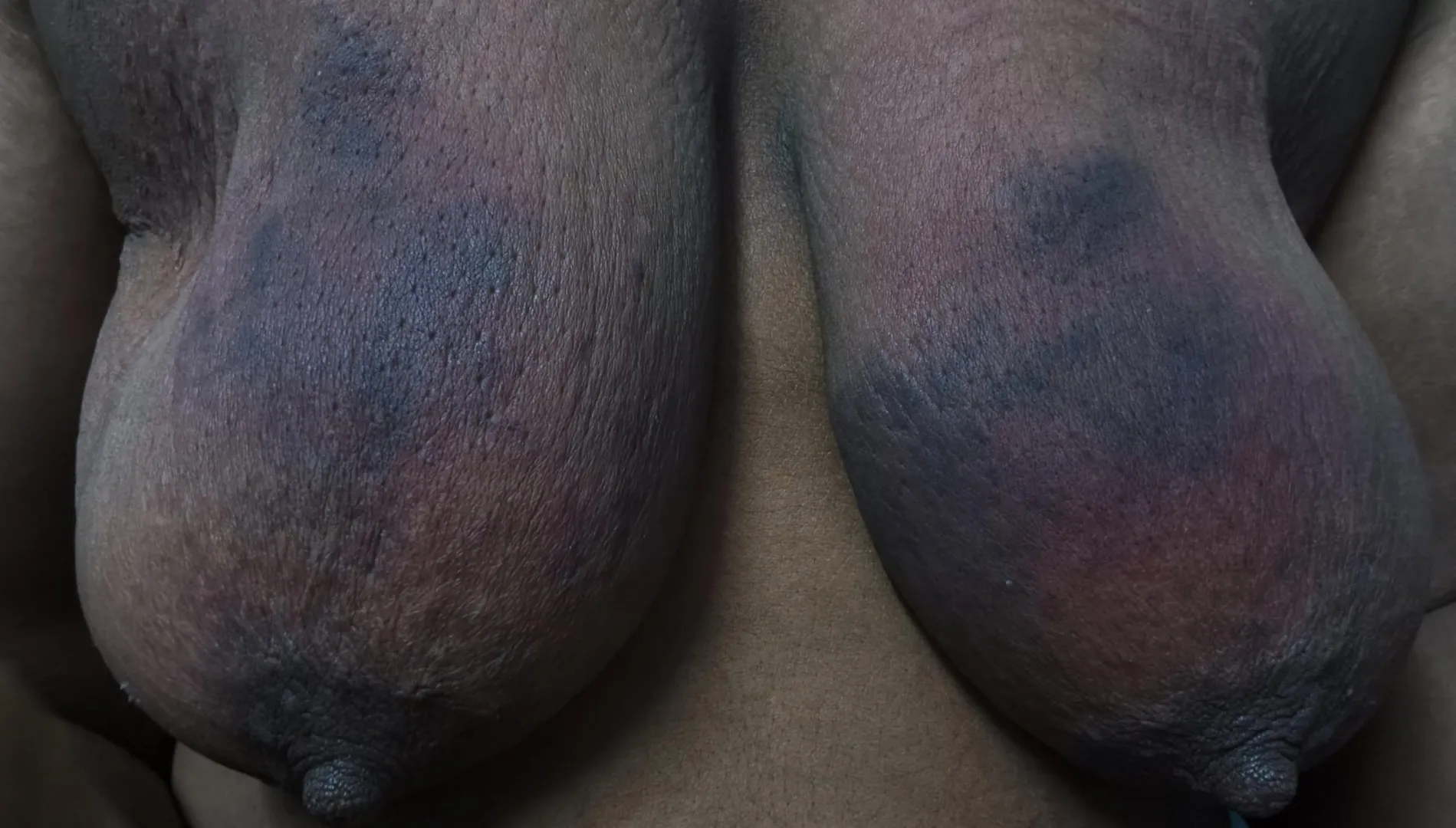 Can i get more ideas to give myself more pain ?