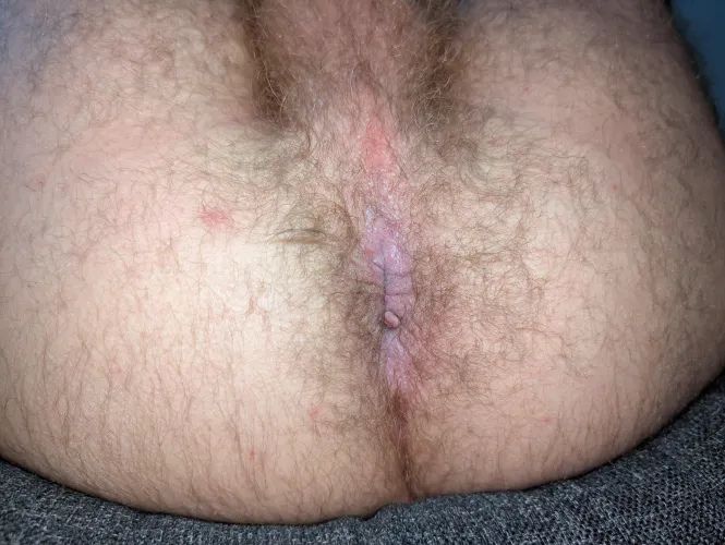 Morning hole