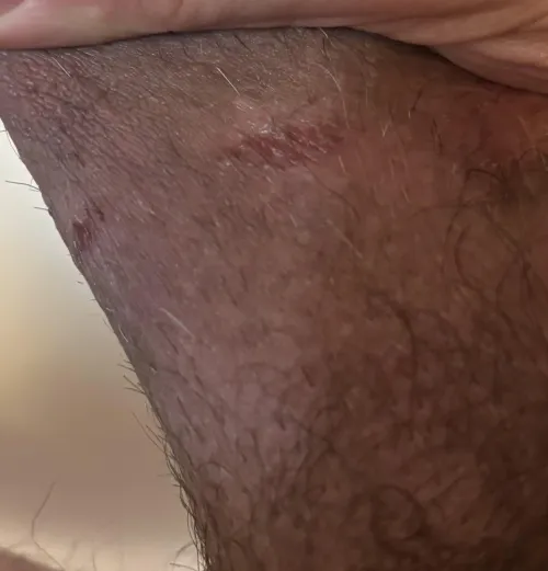 Stretching for sure…hold off or power through?