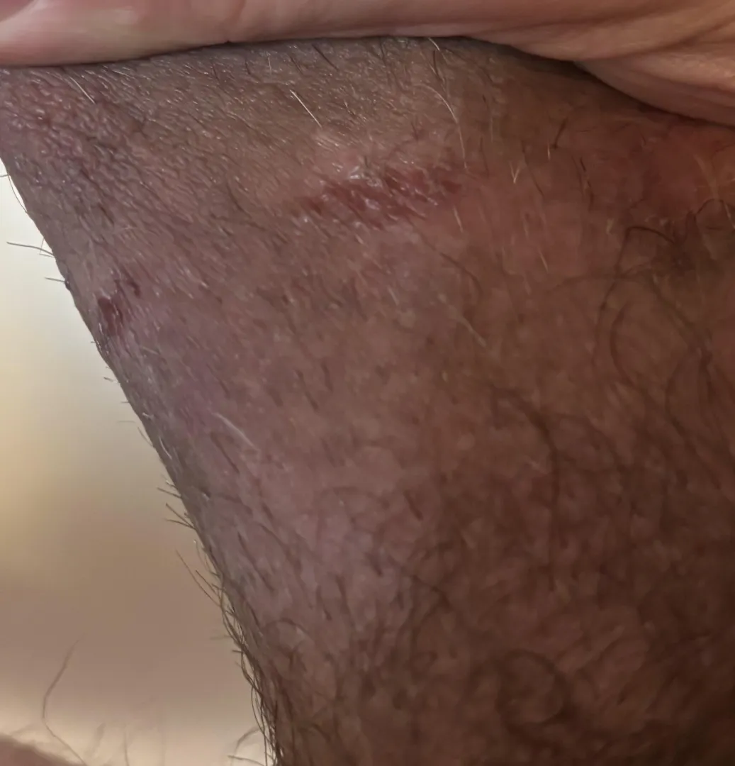 Stretching for sure…hold off or power through?