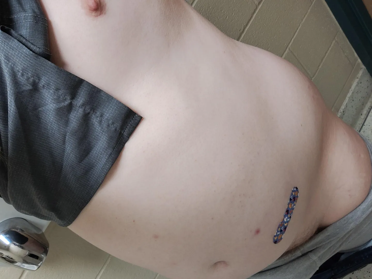 Another post injection pic for trans visibility day