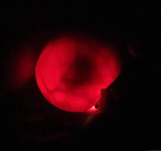 As you seems to be enjoyed my yesterday's glowing tits pic i am gifting you with this with strong flashlight as many suggested...