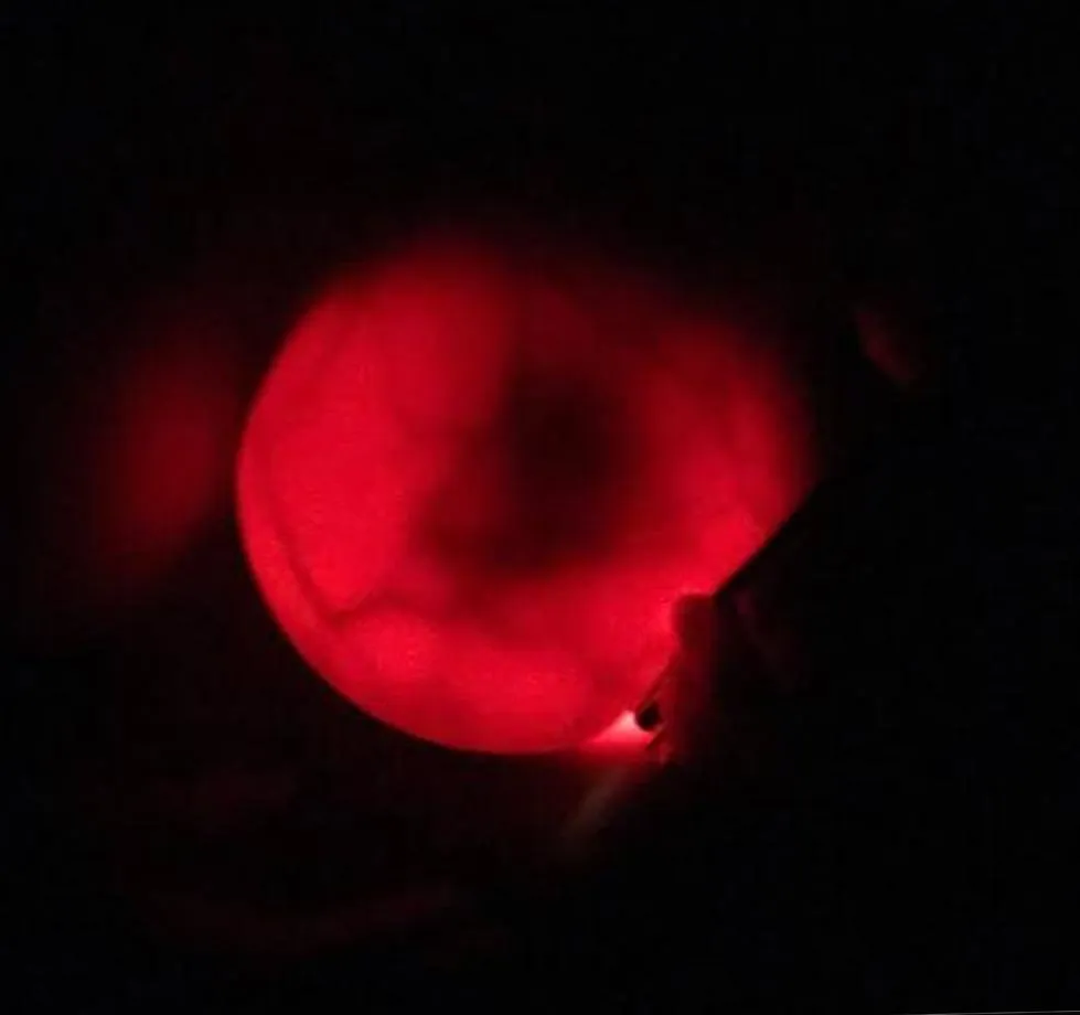 As you seems to be enjoyed my yesterday's glowing tits pic i am gifting you with this with strong flashlight as many suggested...