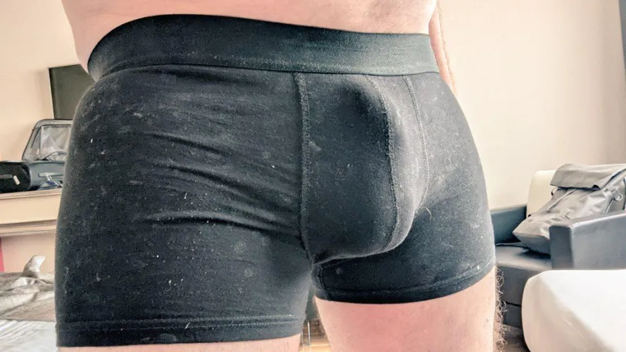 Bulging in the cumrag