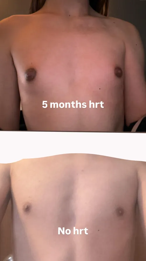My growth was unfortunately not good.. 5 months hrt, EEn,started at 19