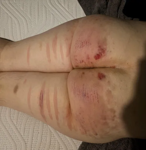 Took my biggest beating yet