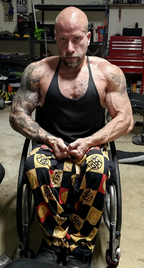 (34M. Spina Bifida, para.)