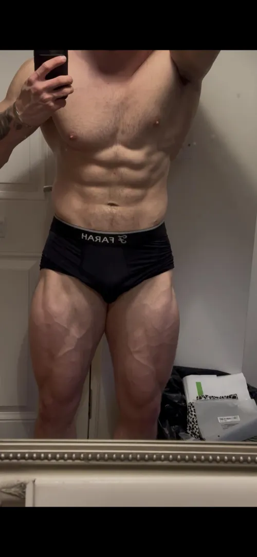 Leg veins are the best part about getting lean