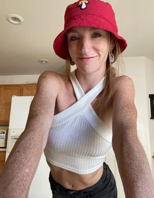 There was a time my freckles made me really insecure