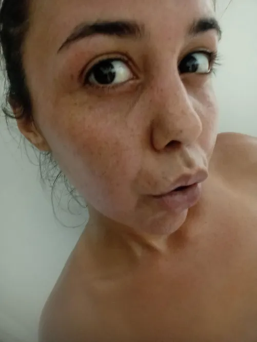 Pecas sudorosas