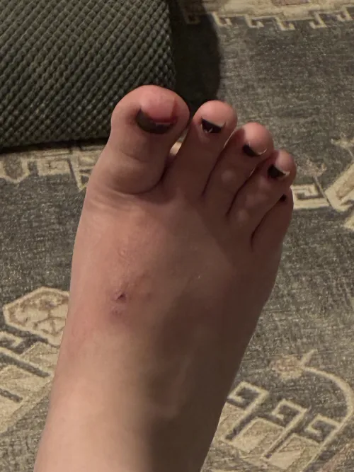 Be careful babes, did feet content for someone and slipped and fell from stepping in gummy bears Toe is in pain [oc]
