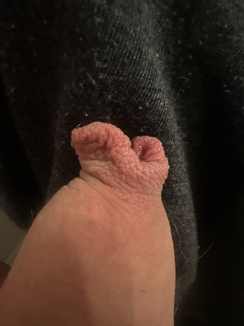 Foreskin