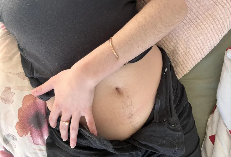 Hairy everywhere, but these little [arms] are beautiful